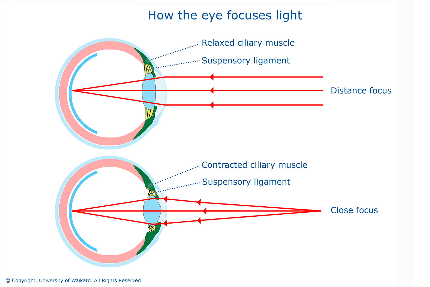 Фокусировка лучей света на внутренней поверхности глазного. Схема аккомодации хрусталика. Аккомодационный аппарат глаза схема. Спазм аккомодации схема. Механизм аккомодации глаза схема.