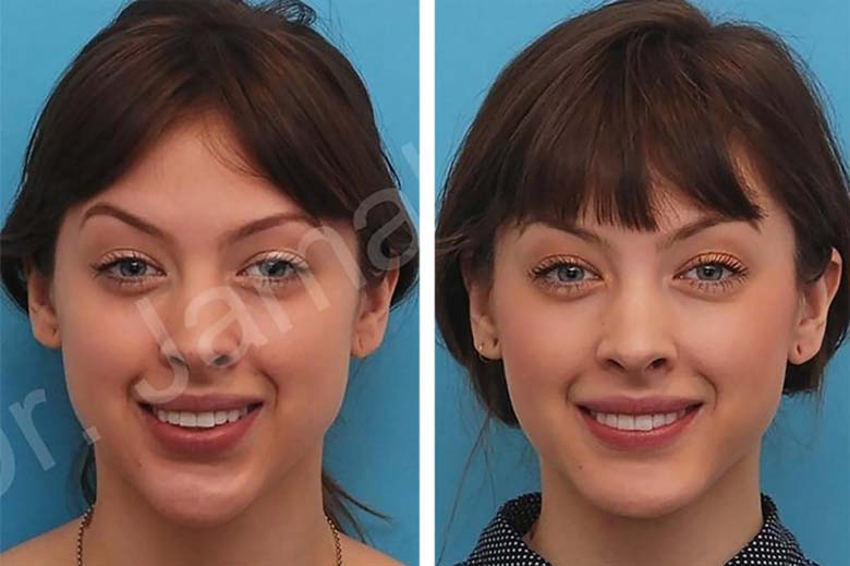 10 Amazing Cosmetic Transformations You Have to See to Believe