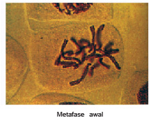Metafase pembelahan mitosis