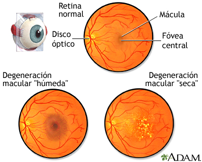 Medical wiki - Oftalmólogos ESPECIALISTAS en RETINA, allí donde