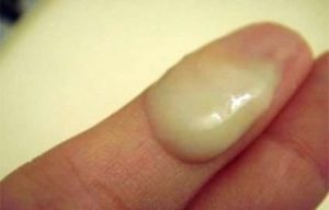 Obat Untuk Penis Keluar Nanah Yang Ampuh Di Apotik Obat Untuk Penis Keluar Nanah Yang Ampuh Di Apotik
