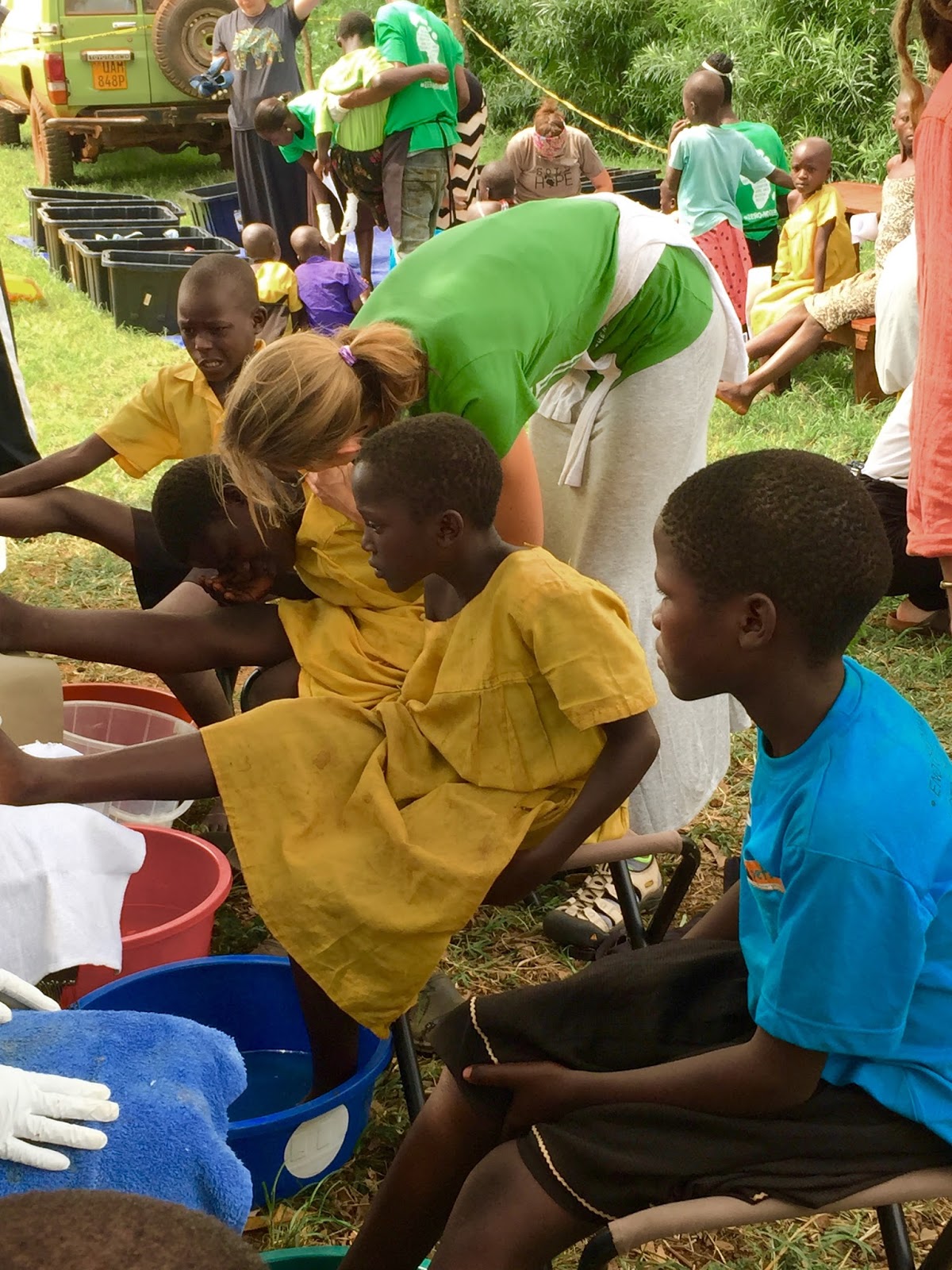 Mommas on a Mission Day 10 Sole Hope Jigger Removal Clinic