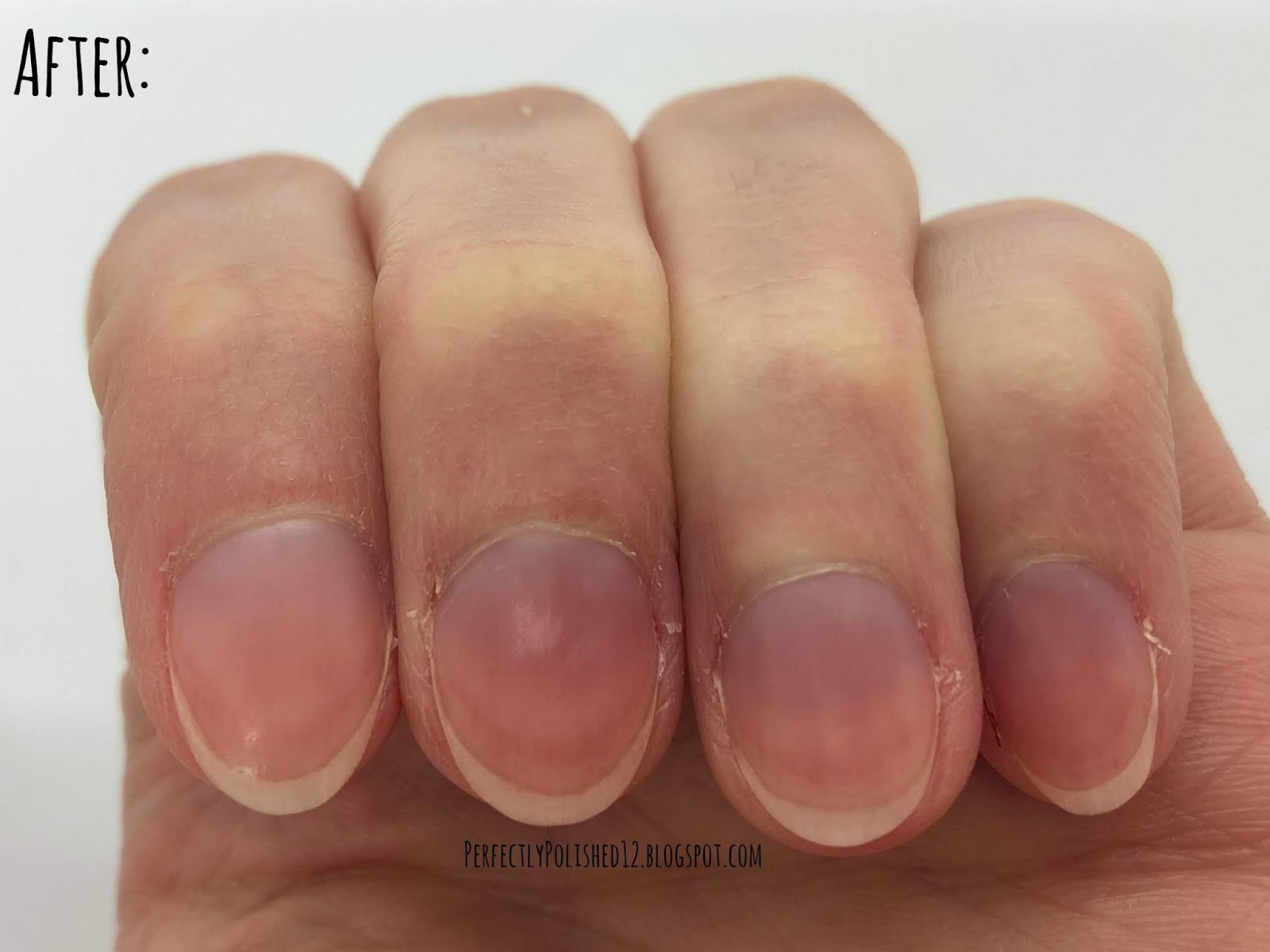 Perfectly Polished 12 Sally Hansen Cuticle Care