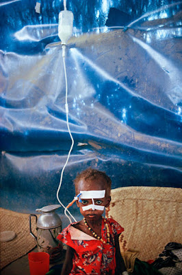 Dziewczynka w szpitalu w Somalii 1992 fot. © Jean-Claude Coutausse, Dziewczynka w szpitalu w Somalii 1992