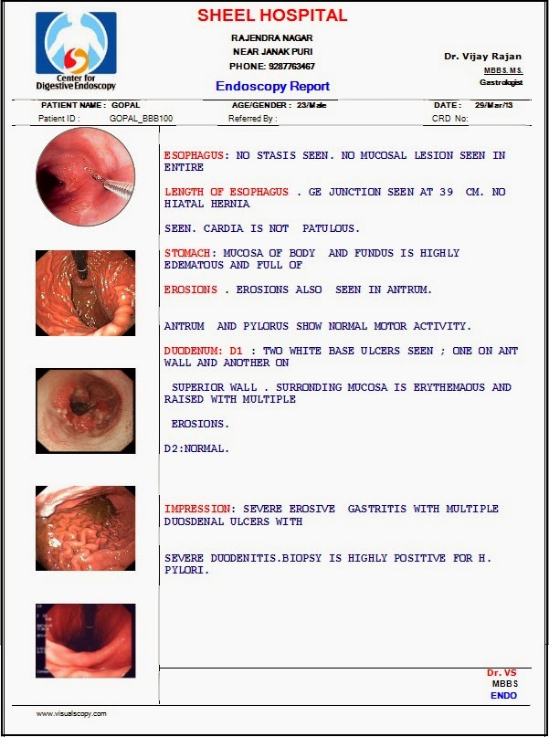 Endoscopy Software