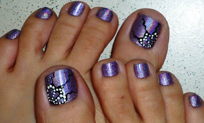 Uñas de Pies Uñas de Pies
