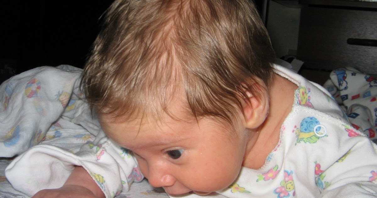 Малыш сильно потеет. Шишка на голове у новорожденного.