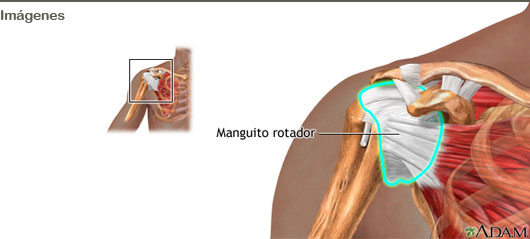 Bursitis subacromiodeltoidea enfermedad profesional