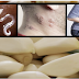 Remove Parasite Inside Your Body With These Natural Remedies Using Garlic and Cucumber