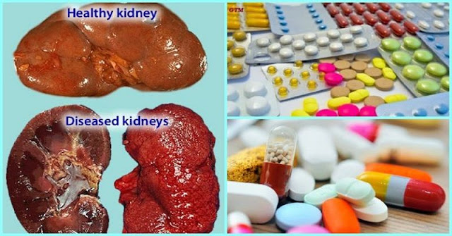 do statin drugs cause kidney damage