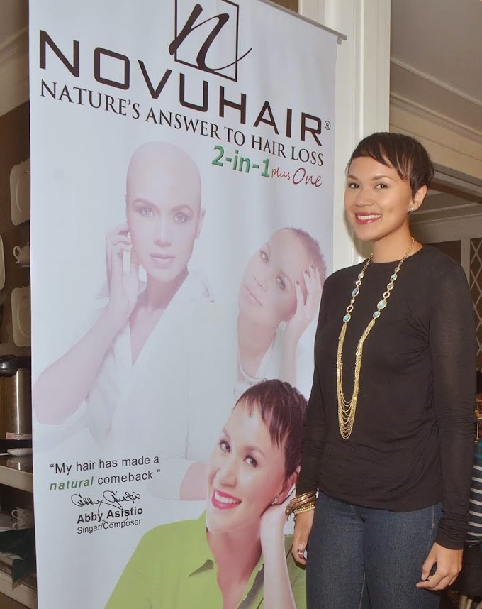 Abby Asistio helps raise awareness on Alopecia Areata