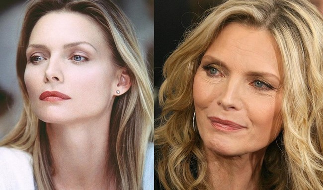 O antes e o depois das mais bonitas atrizes do cinema da década de 80