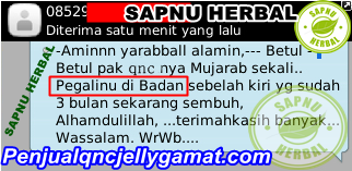 Cara Mengobati Kebas Dan Kesemutan Dengan Cepat Cara Mengobati Kebas Dan Kesemutan Dengan Cepat