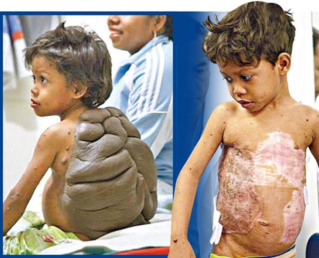 Το παιδί χελώνα The turtle child