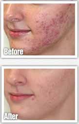 The 6 Best Dark Spot Correctors of 2026, Tested and Expert-Backed - Byrdie