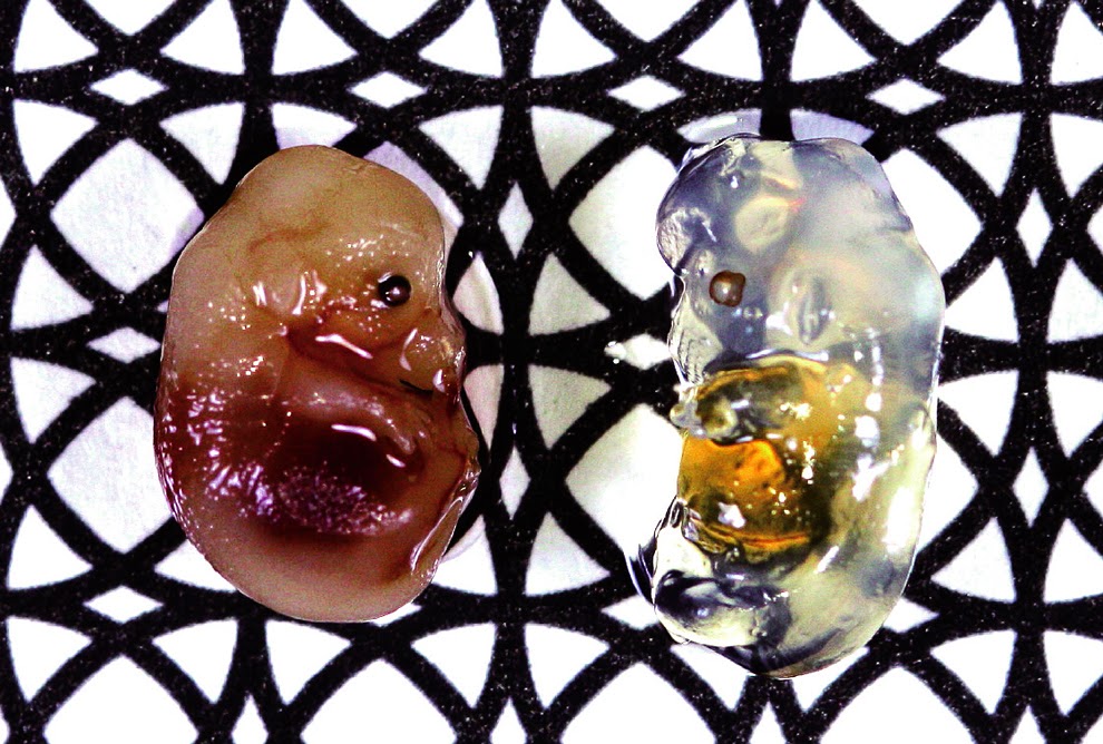 一種特殊溶液 讓腦變透明