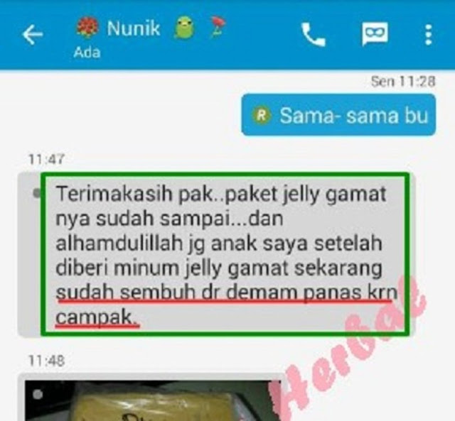 Obat Cacar Air Tradisional, Terbukti Ampuh Menghilangkan Cacar Air Tanpa Bekas Obat Cacar Air Tradisional