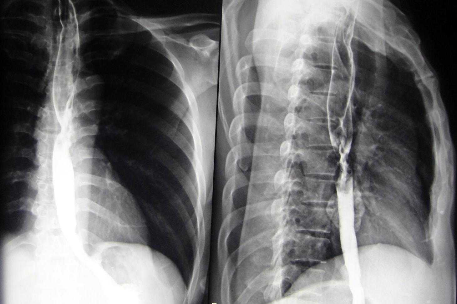 VIETNAMESE MEDIC ULTRASOUND CASE 142 MULTIFOCAL LIVER and VOMITTING