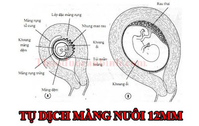 Ăn gì và không nên ăn gì nếu mẹ bị tụ dịch màng nuôi? - 1