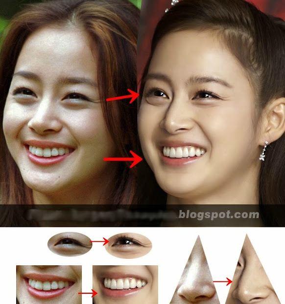 Park Min Young Before And After Surgery Imgurl