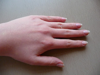eveline, 8w1 total action, odżywka do paznokci. łamliwe paznokcie, rozdwajanie, odbudowa płytki paznokcia