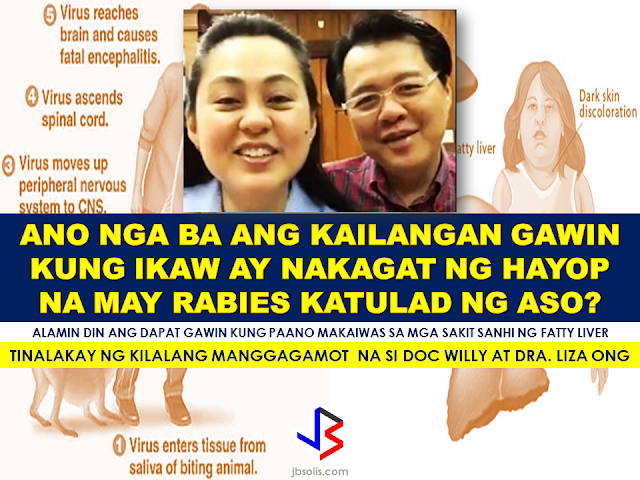 Dr. Willie Ong together with  his wife Dr. Liza Ong made a Facebook live of important health tips about rabies and fatty liver.  Dr. Ong has been doing health tips that are very useful in our everyday life from simple common diseases to more complex health issues, providing education and knowledge on how to deal with them for everyone.    In the first video, Dra Liza Ong discussed about rabies. What to do if you got bitten or scratched by animals suspected to carry rabies virus?   According to Dr Liza Ong, rabies has an incubation period of 90 days from the first day of  the bite. It will be the critical period where we need to observe the patient.    "In the Philippines, common animals that carry rabies virus are dogs and cats," Dr. Liza said. Bats can also carry rabies. Animals can have rabies from being infected from contacts with other animals that carry the virus.    What do you need to do when you got bitten by a rabid animal?  1. Wash the affected part with soap and water. The lipids on the surface of the rabies virus  can be killed by soaps in contact.    2. Apply antiseptics like alcohol or povidone iodine.   3. Do not cover or suture the wound.     4. Do not put any cream, garlic, turmeric powder, coffee, toothpaste or any self medication.    5. Go to the nearest Animal Bite Center immediately for anti-rabies vaccination.           The second segment of the video talks about fatty liver, its causes and preventions. Dr. Willie Ong tackles about the risk of having a  fatty liver.      Fatty liver is not really a thing to ignore. It can be fatal and is considered the number one cause of liver transplant which , in the Philippines, can cost you P4,000,000 to P5,000,000, according to Dr. Ong.   The chart shows the stages of liver damage as shown by Dr. Willy Ong   Dr. Ong warns people about fatty foods, alcoholic beverages and even taking medicines in tablet form. It can be a cause of having unhealthy or fatty or it can possibly damage the liver       SYMPTOMS OF LIVER CIRRHOSIS  To avoid liver cirrhosis, you need to do the following:  1.Avoid fatty foods.   2.Avoid alcoholic drinks.   3.Avoid too much salt.   4.Eat more fruits and vegetables.   5. Engage in regular exercise like jogging, biking, etc.       Dr. Willie Ong and his wife are providing right and useful health tips for the 10 million Filipinos  to live well and to live longer.      For more health tips, you can visit their Facebook page.            RECOMMENDED:  ASEAN LEADERS TO CREATE PROTECTION RULES FOR MIGRANT WORKERS  OFW GETS HARSH WORDS FROM OWN BROTHER  10 TIPS ON HOW TO SPOT A FAKE NEWS  BEFORE YOU GET MARRIED,BE AWARE OF THIS  ISRAEL TO HIRE HUNDREDS OF FILIPINOS FOR HOTEL JOBS  MALLS WITH OSSCO AND OTHER GOVERNMENT SERVICES  DOMESTIC ABUSE EXPOSED ON SOCIAL MEDIA  HSW IN KUWAIT: NO SALARY FOR 9 YEARS  DEATH COMPENSATION FOR SAUDI EXPATS  ON JAKATIA PAWA'S EXECUTION: "WE DID EVERYTHING.." -DFA  BELLO ASSURES DECISION ON MORATORIUM MAY COME OUT ANYTIME SOON  SEN. JOEL VILLANUEVA  SUPPORTS DEPLOYMENT BAN ON HSWS IN KUWAIT  AT LEAST 71 OFWS ON DEATH ROW ABROAD  DEPLOYMENT MORATORIUM, NOW! -OFW GROUPS  BE CAREFUL HOW YOU TREAT YOUR HSWS  PRESIDENT DUTERTE WILL VISIT UAE AND KSA, HERE'S WHY  MANPOWER AGENCIES AND RECRUITMENT COMPANIES TO BE HIT DIRECTLY BY HSW DEPLOYMENT MORATORIUM IN KUWAIT  UAE TO START IMPLEMENTING 5%VAT STARTING 2018  REMEMBER THIS 7 THINGS IF YOU ARE APPLYING FOR HOUSEKEEPING JOB IN JAPAN  KENYA , THE LEAST TOXIC COUNTRY IN THE WORLD; SAUDI ARABIA, MOST TOXIC  "JUNIOR CITIZEN "  BILL TO BENEFIT POOR FAMILIES ©2017 THOUGHTSKOTO