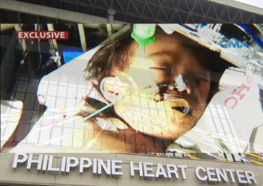 Nurse in Philippine Heart Center charged with malpractice