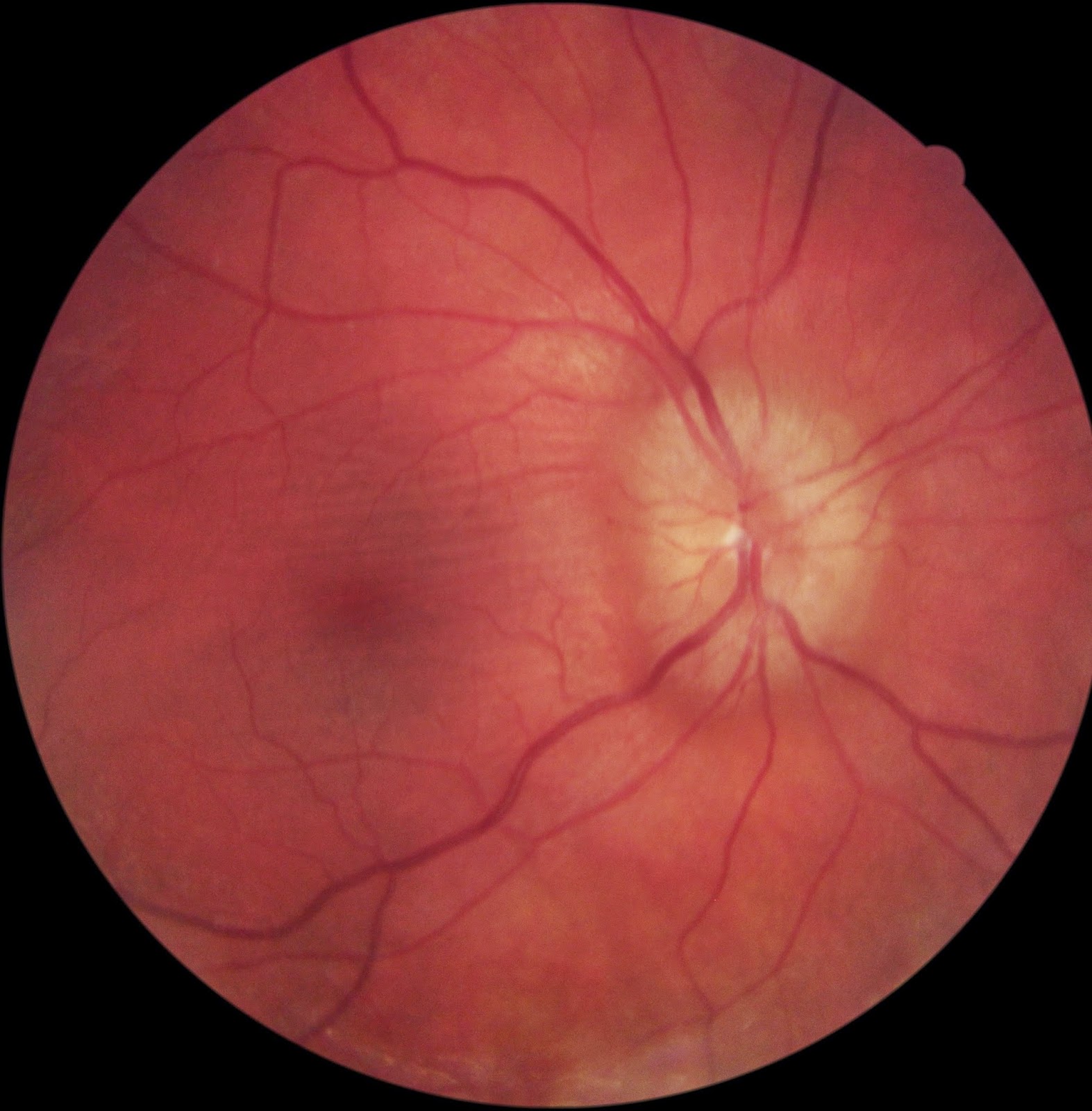 images-eyedolatry