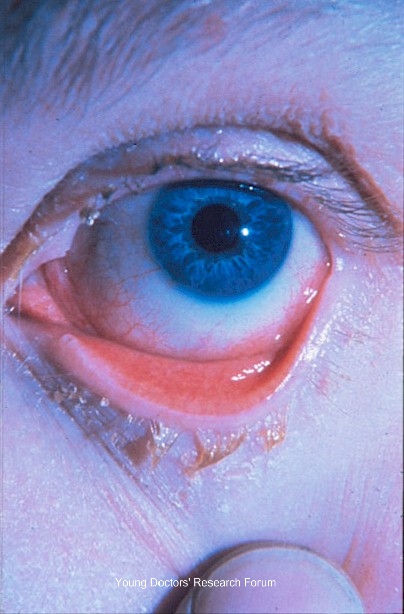 Purulent surgery essays 08 image