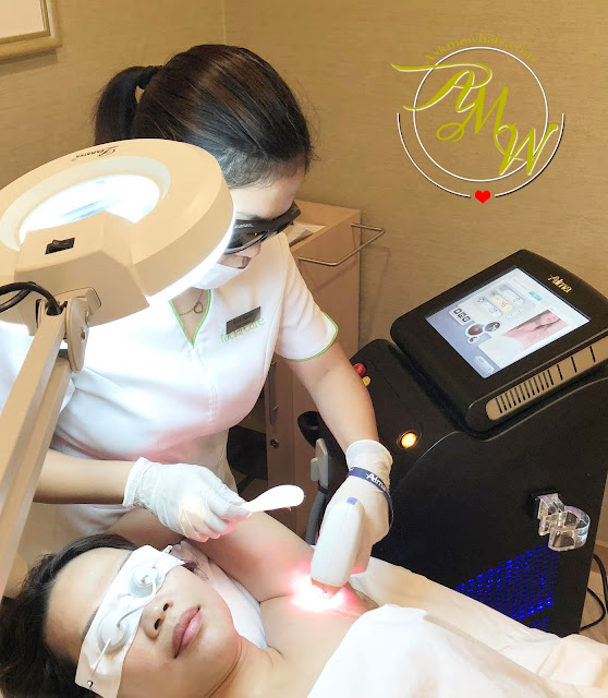 a photo of Facial Care Centre LaserLight review for underarm.