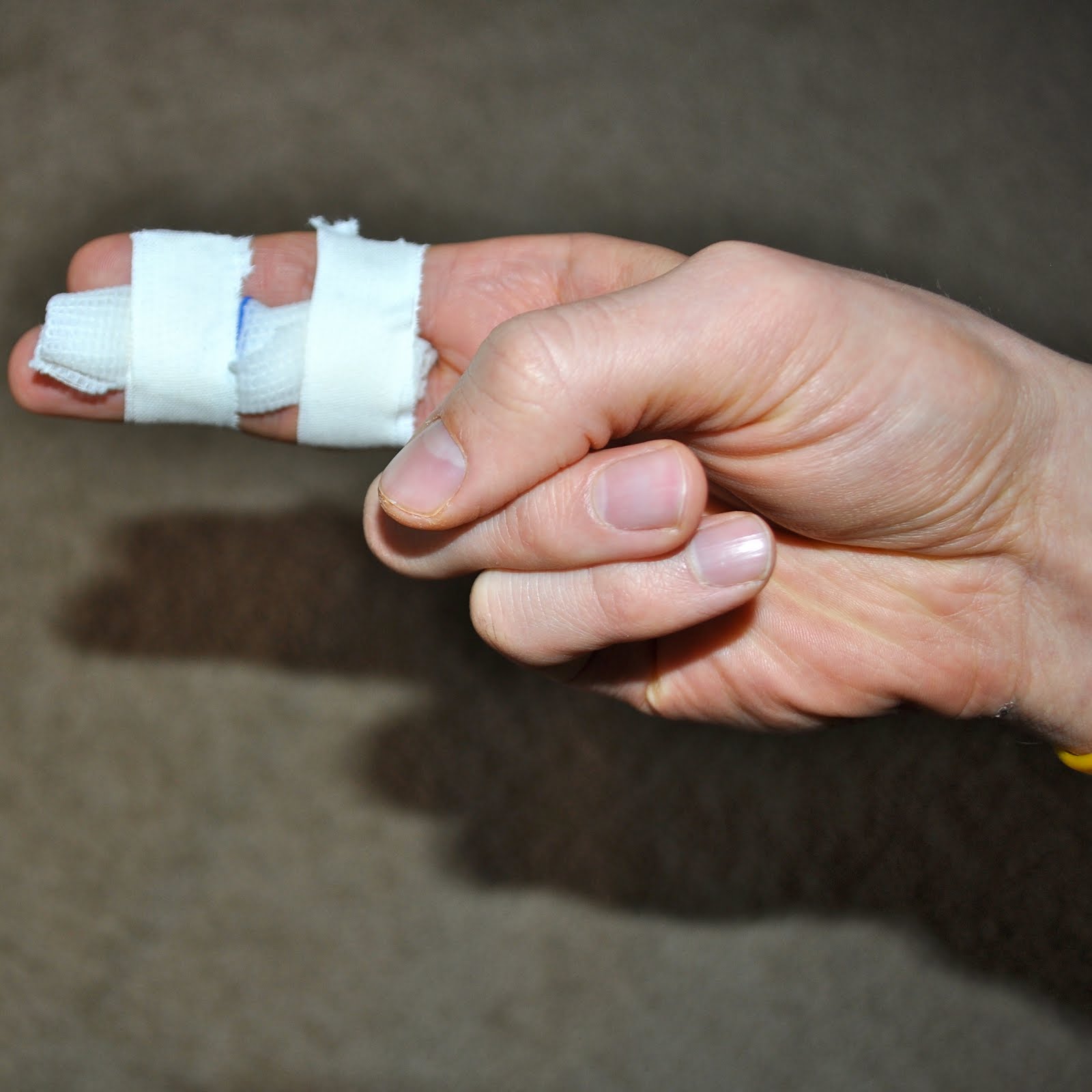 The Oddity of Triggered Memories