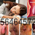Cara Tepat Mengempeskan Benjolan Ambeien (Hemoroid) thumbnail