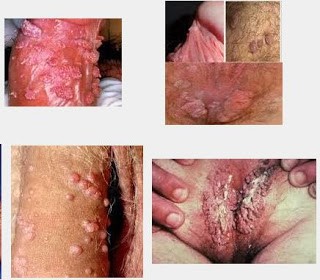 Dokter Spesialis Kelamin Klinik Kelamin dan Rekomendasi Obat Ampuh Penyakit Kelamin Dokter Spesialis Kelamin Klinik Kelamin dan Rekomendasi Obat Ampuh Penyakit Kelamin