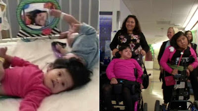 1a8 Formerly Conjoined Twins Josie Hull and Teresa Cajas celebrate 15th birthday
