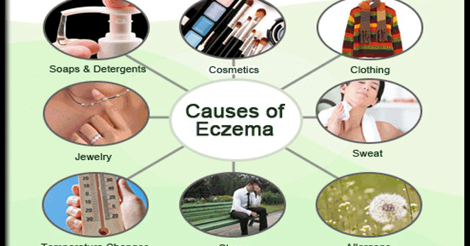 Anne How to Cure Children’s Eczema