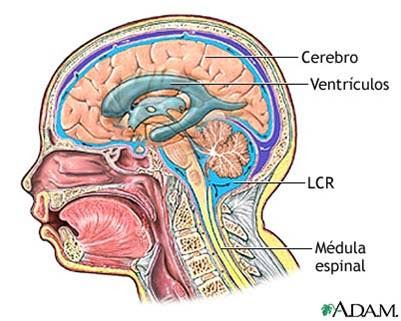 Pasos de diagnóstico de hidrocefalia