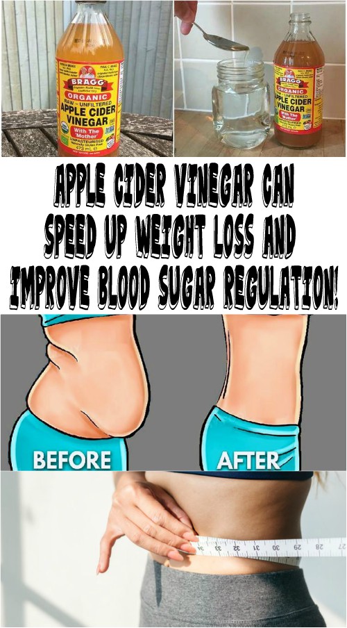 APPLE CIDER VINEGAR CAN SPEED UP WEIGHT LOSS AND IMPROVE BLOOD SUGAR
