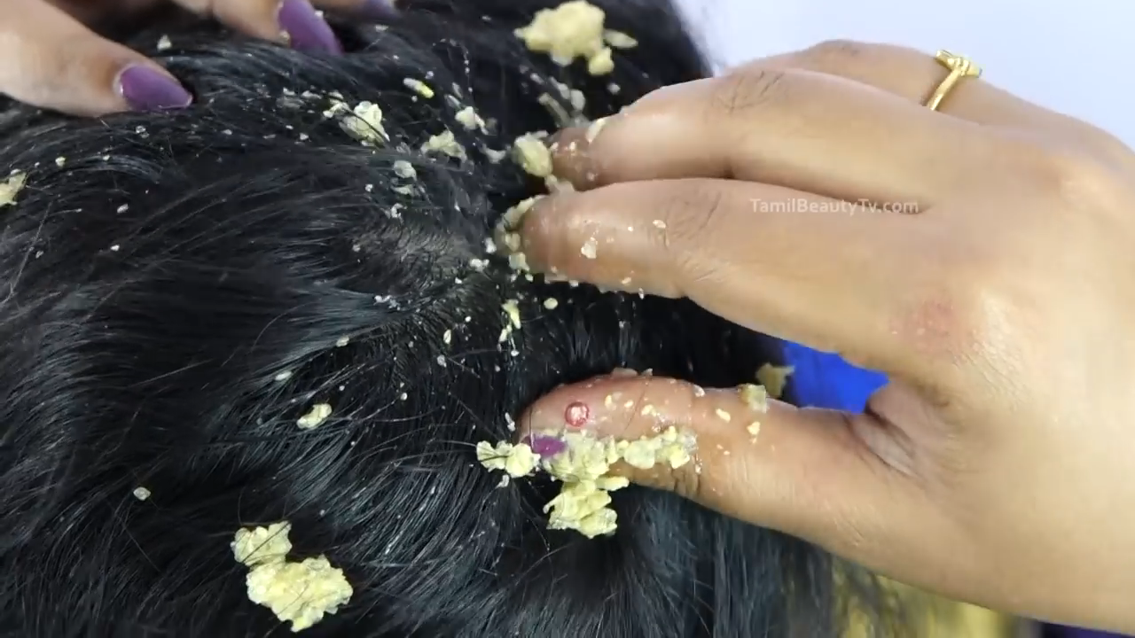 Tips To Stop And Reduce Hair Fall Naturally Beauty Tips