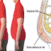 Thinner People With Excess Abdominal Fats Were Likely To Pass Away Early Than Overweight Ones
