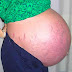 Elle tombe enceinte et son ventre se met à exploser! Les docteurs n'en croient pas leurs yeux!