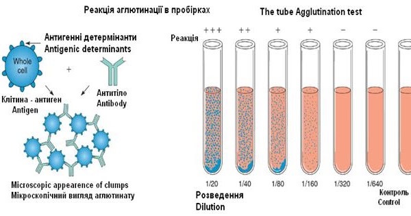 методы постановки реакции агглютинации. ориентировочная реакция агглютинации микробиология. развернутая реакция агглютинации в пробирках. реакция агглютинации в пробирках схема. схема постановки реакции агглютинации.