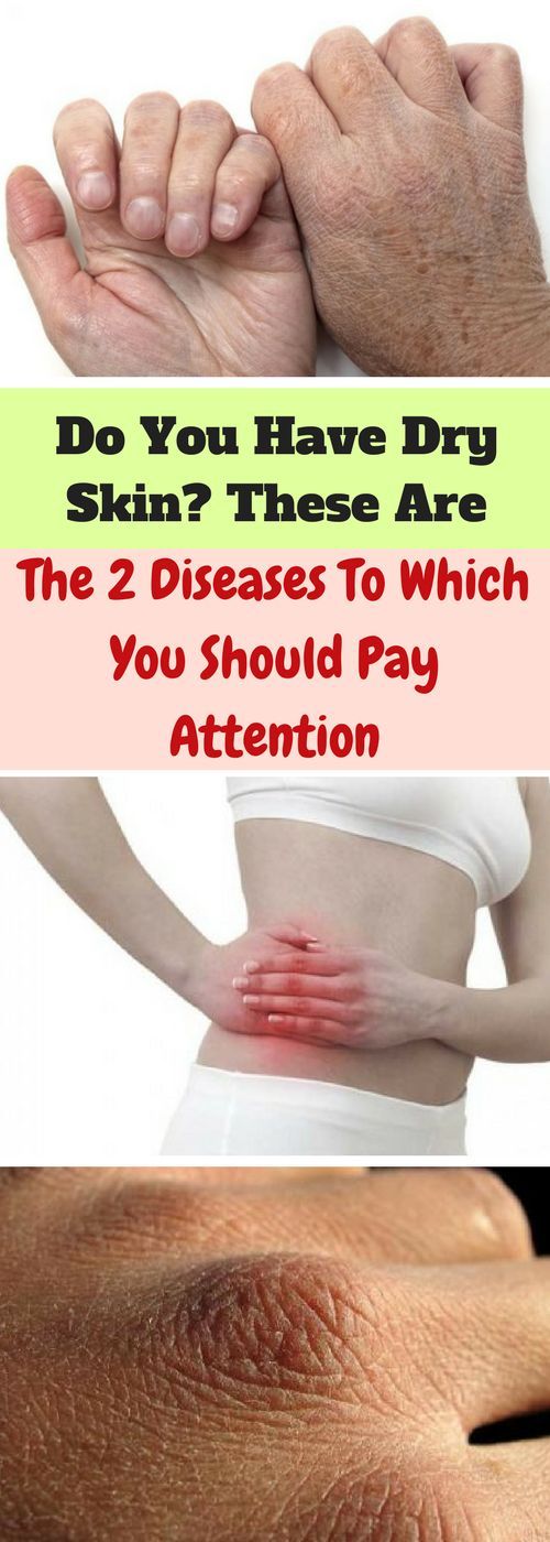does steam help dry skin does steam help dry skin