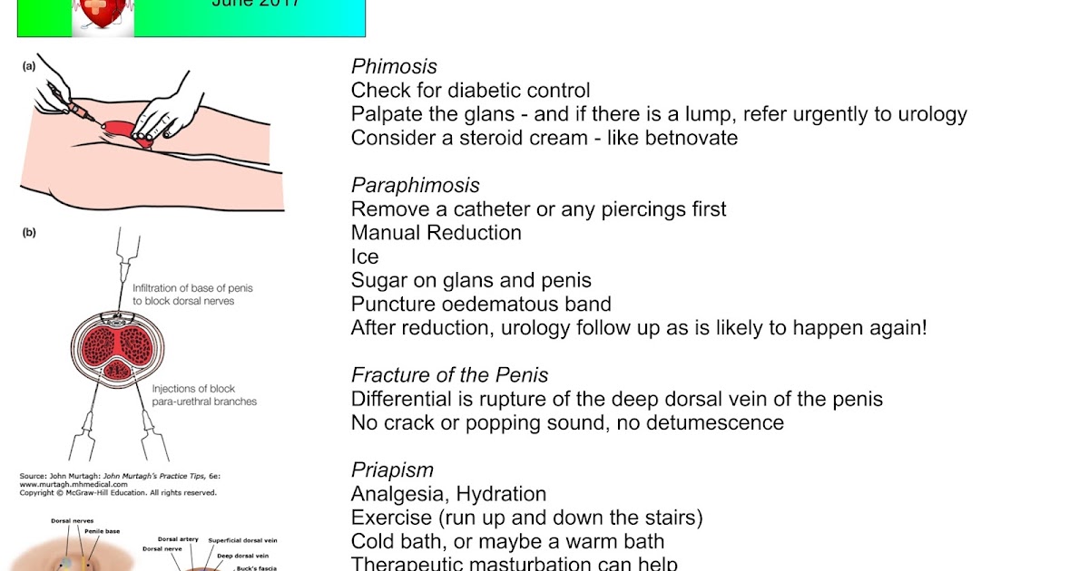 steroid cream on the penis Asu porn cheer