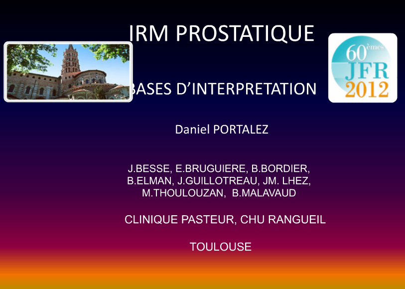Irm Prostatique Ma Bibliotheque En Imagerie Medicale