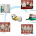 Tìm hiểu công đoạn khiến răng giả tại nha khoa
