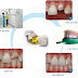 Tìm hiểu công đoạn khiến răng giả tại nha khoa