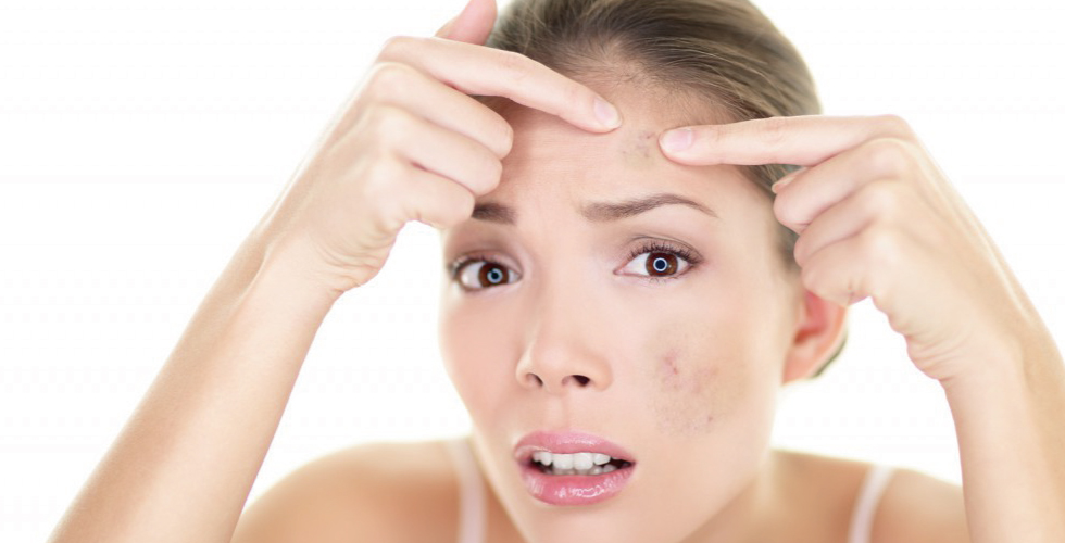 ISKIN Health&Beauty Medical Center 白頭黑頭粉刺都不怕