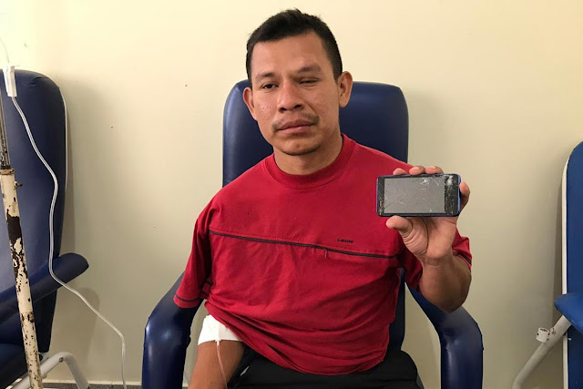 'Não foram balas de borracha', diz venezuelano ferido em confronto na fronteira