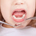 Khi nào nên nhổ răng sữa?