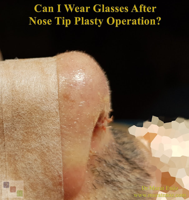 When can you resume wearing glasses after nose tip plasty operation? - When can I wear glasses after nose tip plasty operation? - How to wear glasses after nose tip plasty operation? - How to wear eyeglass / sunglasses after nose tip plasty operation? - When to wear glasses after nose tip plasty operation? - Wearing glasses after nose tip plasty operation - Wearing glasses after nose tip plasty - When can I start to wear glasses after nose tip plasty operation? - Can I wear glasses after nose tip plasty operation? - How long after nose tip surgery until I can wear glasses? - Wearing glasses after nose tip plasty